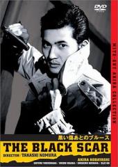 黑伤后的布鲁斯